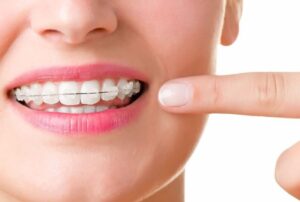 303 Smiles - Invisalign & Orthodontics