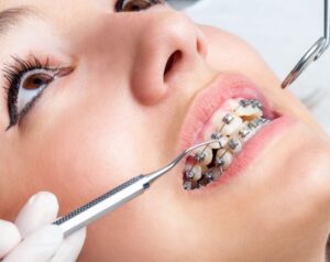 303 Smiles - Invisalign & Orthodontics