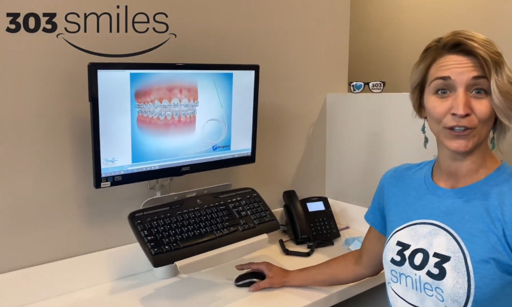 9 Tips to Set You Up for Braces Success