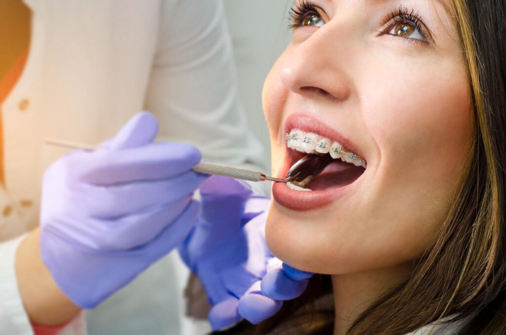 How Can I Accelerate My Orthodontic Treatment?