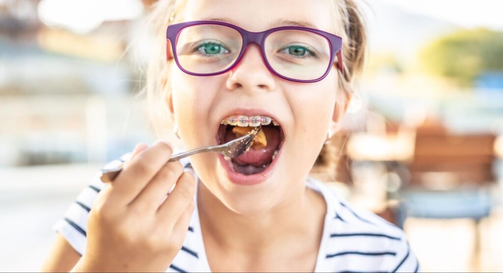 Fall Foods to Avoid with Braces in Greenwood Village