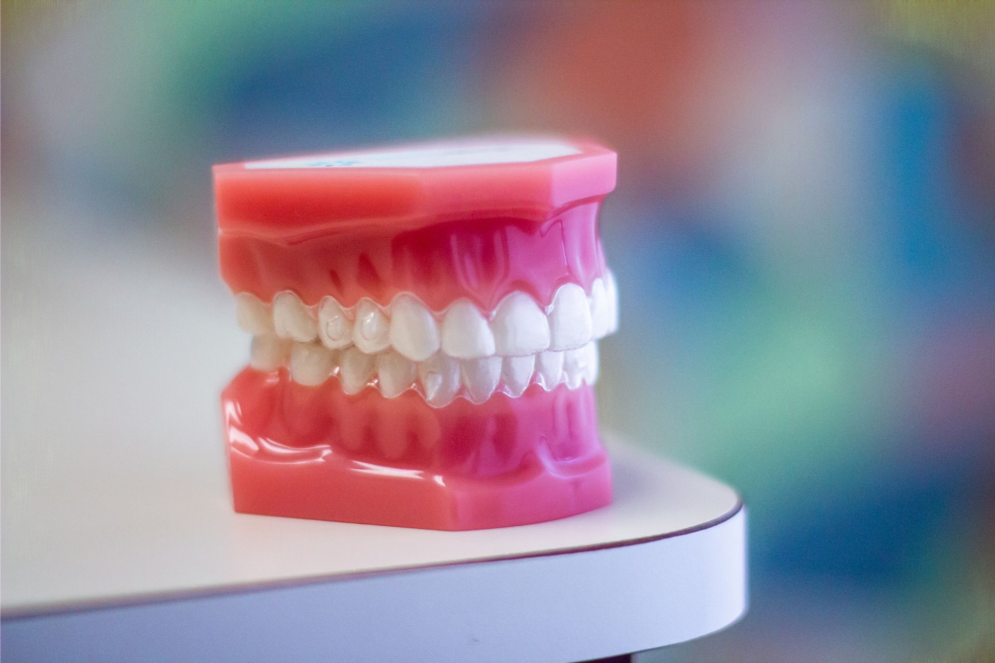 Model of teeth in pink orthodontic mold demonstrating clear aligners and braces at 303 Smiles, Cherry Hills, CO.